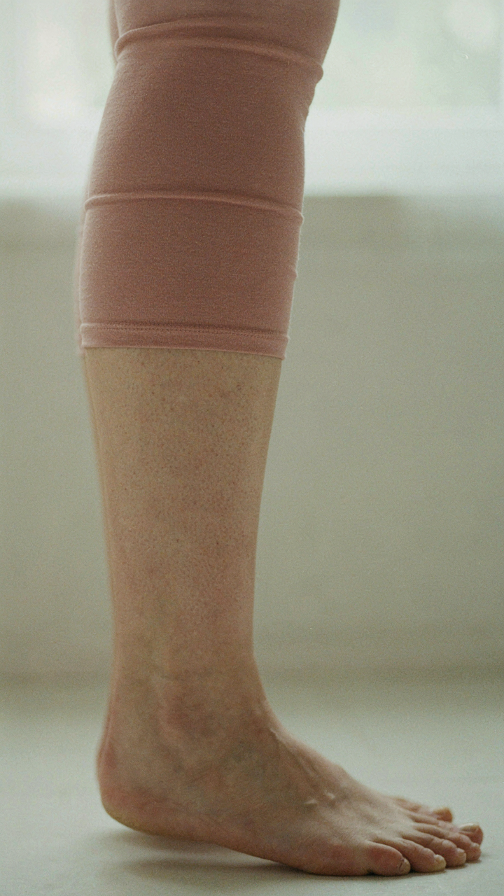 Close up of a woman's swollen ankle and comfortable, stretchy fabric.