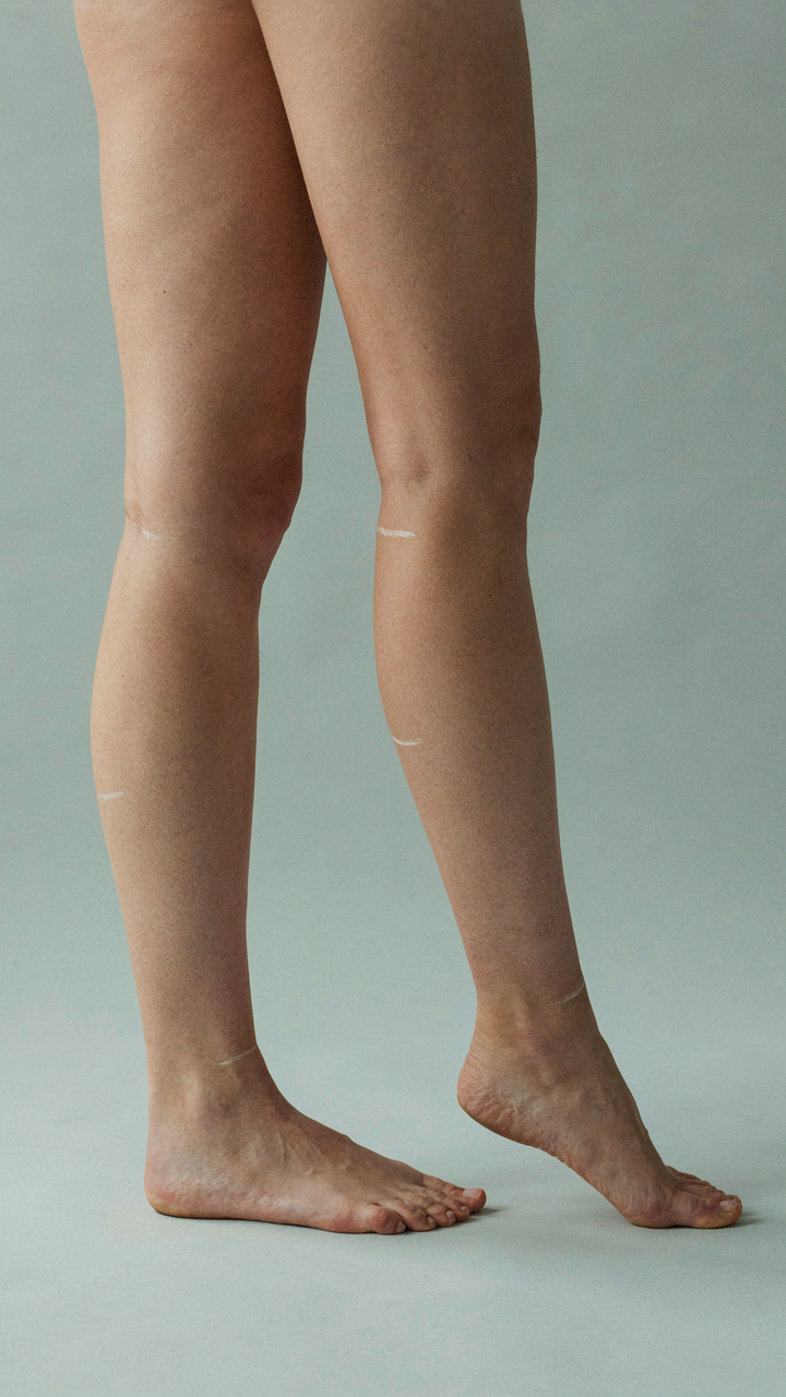A woman's legs marked with different hemline lengths for an a line cocktail dress.